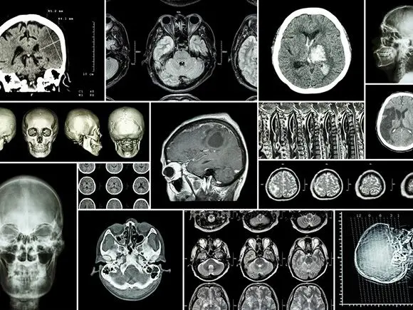 neurochirurgie-(3c-3d)