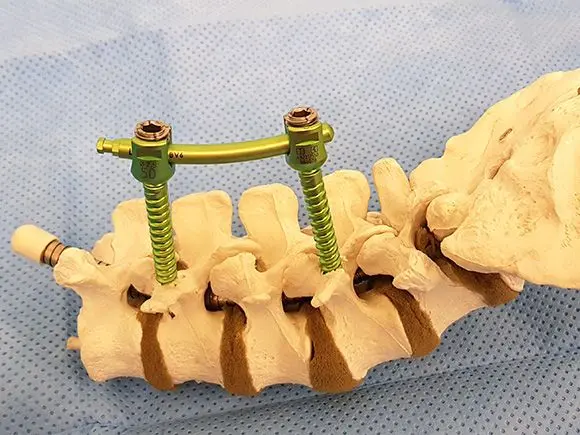 zentral-op-cluster-5-spine-center